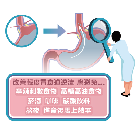 胸悶胸痛、喉嚨異物感、溢酸可能是胃食道逆流！五種方法改善症狀_圖2