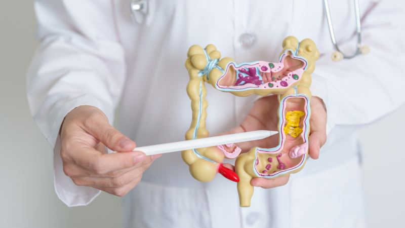 「吃素」能預防大腸癌！胃腸科醫師點名：再搭配「這關鍵食物」大腸癌風險降43％