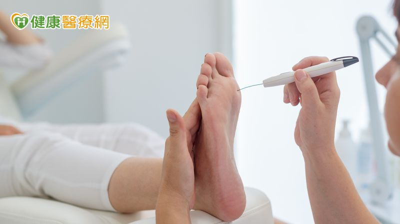 曾小姐格外重視足部周邊神經併發症風險，參與中榮研究並用主動式短波近紅外高光譜成像儀追蹤，在妥善控制血糖時，也確保足部狀態維持良好。