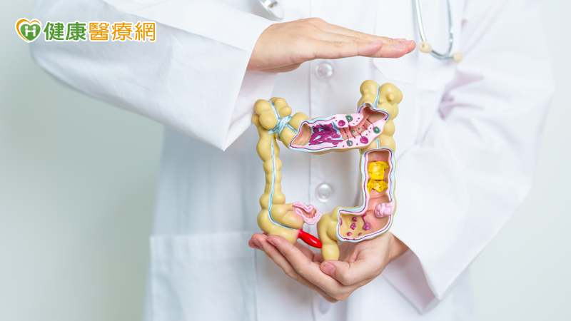 一項分析45篇回溯性研究的報告指出，飲食中如果攝入較高的總膳食纖維、鈣和優格攝取量，並且吃較低的酒精和紅肉，可以降低結腸癌發病率。