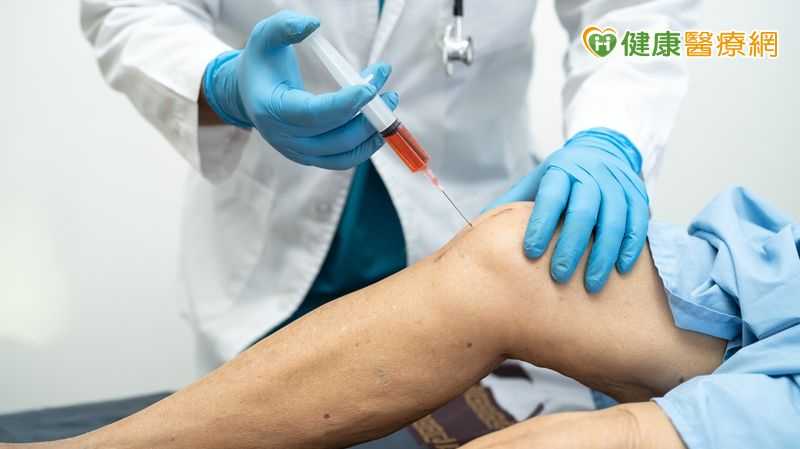 PRP是抽取自體約10cc血液，分離出血小板注射到傷處，以血小板即有的生長因子直接促進細胞增生、軟骨修復和血管生成。