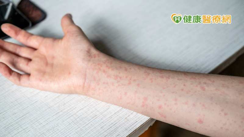 上週國內新增2例麻疹本土病例，為一起麻疹群聚事件，是國內今年第2起境外移入導致本土的群聚事件。