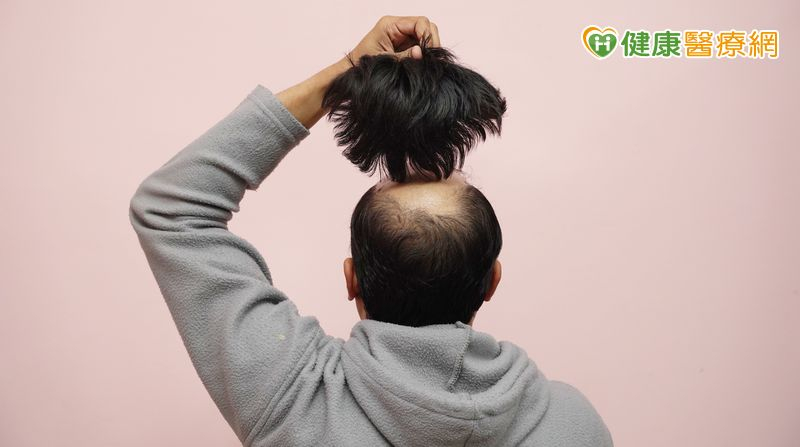 倘若經常長時間使用假髮，讓頭皮悶住，又沒有做好清潔與整理，就可能使頭皮不透氣，進而阻塞毛孔而發炎，頭皮發炎嚴重的話就可能導致掉髮。