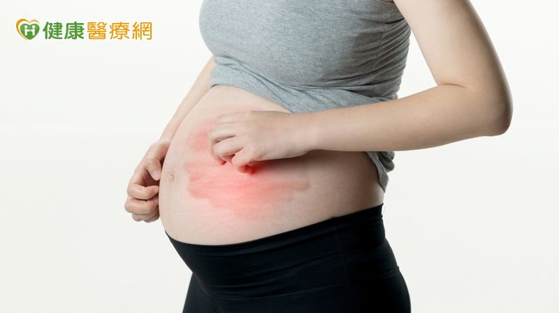 懷孕過程中免疫系統變化可能導致紅斑性狼瘡惡化，常見病徵包括皮疹、關節痛及腎功能異常等。