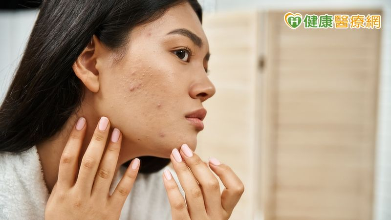 排卵障礙型月經異常常伴隨月經稀少、痤瘡、多毛、體重增加與不孕等現象。