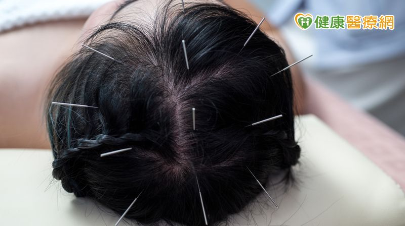 近年許多研究皆顯示，中風後針灸若能搭配中藥的調理，能更進一步的促進神經學症狀的修復。