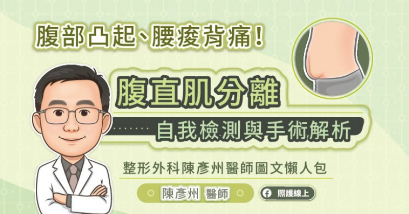 腹部凸起、腰痠背痛！腹直肌分離自我檢測與手術解析。