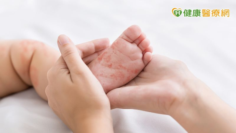 如果家中其他成員有疑似腸病毒症狀，應該做好隔離、避免接觸孕婦及新生兒。