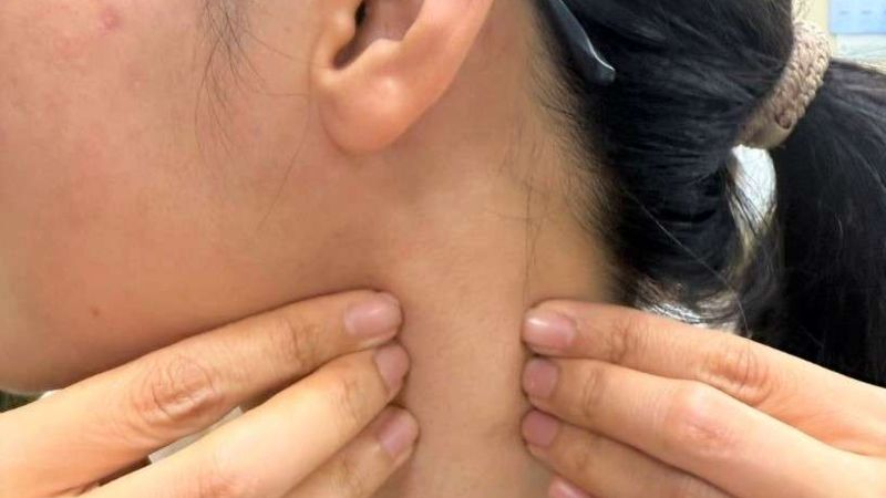 「顳顎關節障礙」逐漸成為常見文明病。圖：部桃提供