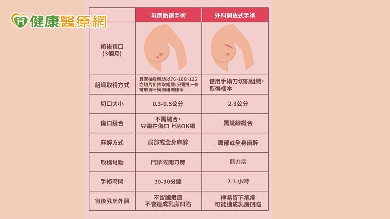 乳房腫瘤4種情況該切除!醫解析「微創手術適應症與優勢」 2ca6390335979ac134c280c48b38d555