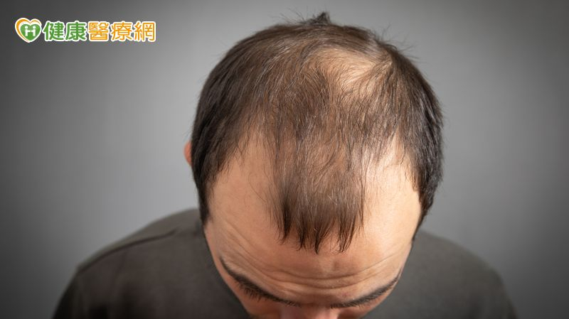 禿頭族新福音?台大研發「含天然脂肪酸」生髮精華 20天促小鼠毛髮再生 c46d6ccb37bc388c1f81f2b838113bf4 l