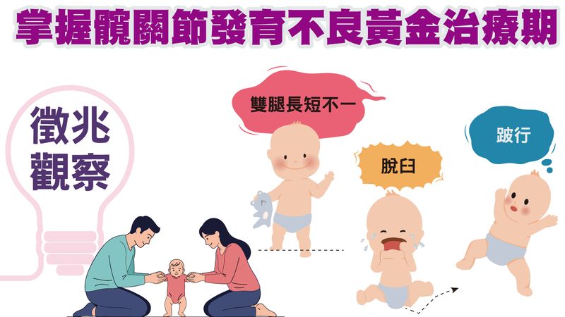 孩子換尿布有咔嗒怪聲?醫:恐是髖部問題 及早發現避免終生跛行 30b2870ba6bf2942c9b72d74156371a9