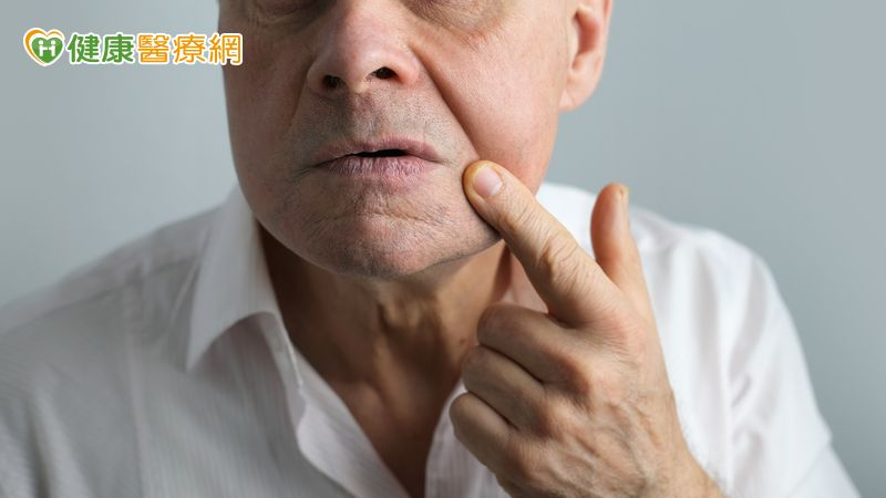 別輕忽不痛不癢的痣！七旬翁拖兩年竟變皮膚癌