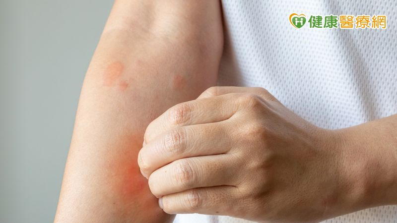 乾癢脫屑反覆發作 可能不只是氣候乾燥!中醫談常見類型與日常保養 乾癢脫屑反覆發作 可能不只是氣候乾燥!中醫談常見類型與日常保養