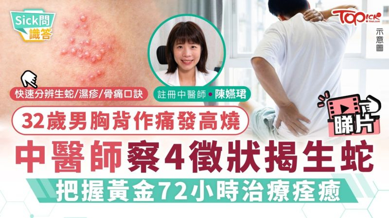 32歲男胸背作痛發高燒　中醫師察4徵狀揭生蛇 把握黃金72小時治療痊癒
