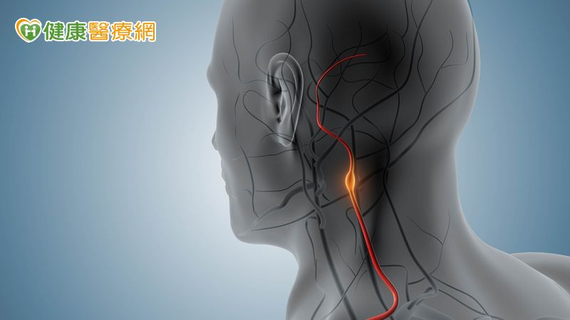 常頭暈又單側手腳發麻！醫警示：頸動脈狹窄恐釀中風風險