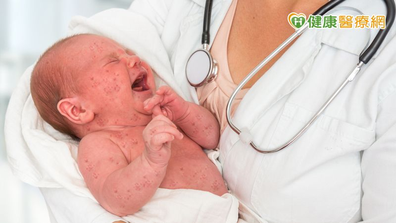 「怎麼抱」攸關寶寶髖關節發育是否正常　醫籲：六個月是治療黃金期