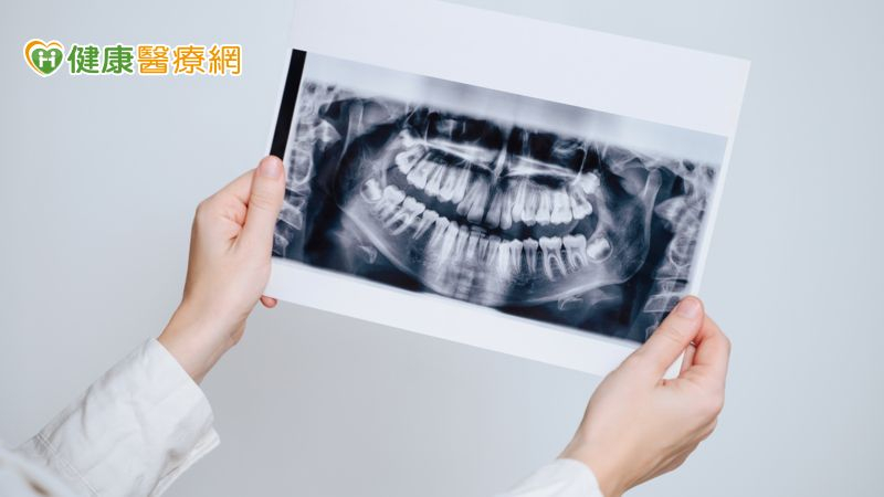 於口腔顎面醫療中接受牙科診斷性 X 光檢查，會增加罹患良性腦瘤之風險，但與惡性腦瘤之風險無顯著相關。