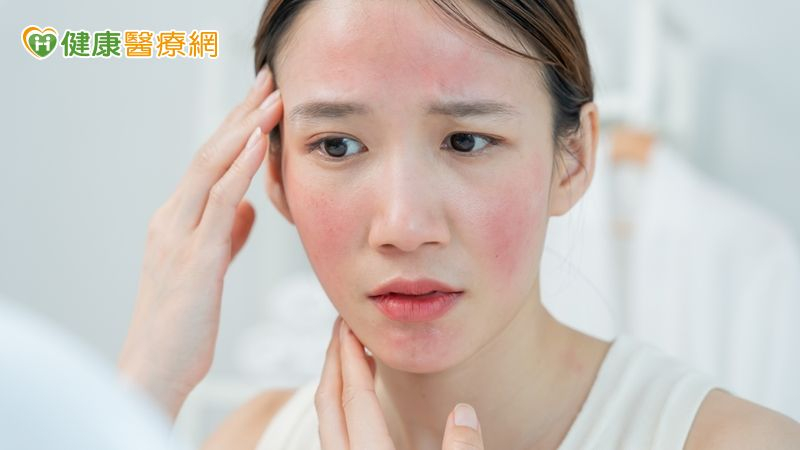 妝容不服貼還伴隨刺癢灼熱　當心是酒糟膚質在作祟