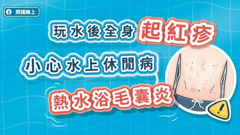 玩水後全身起紅疹，小心水上休閒病–熱水浴毛囊炎