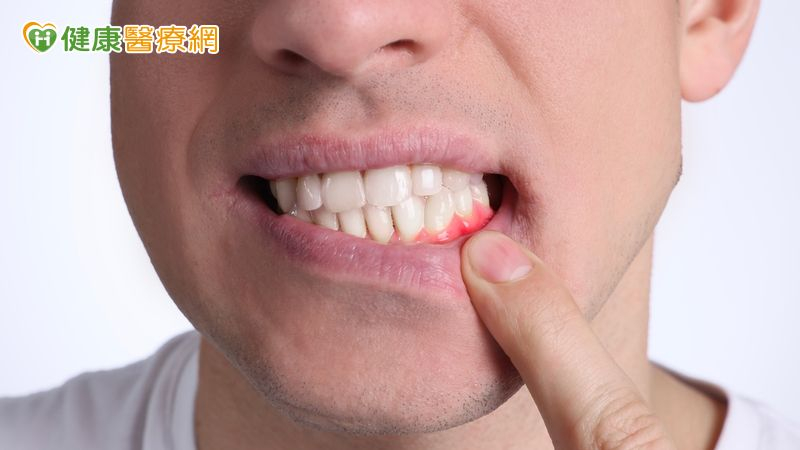 加國病人牙齦萎縮影響進食來台求醫　「新式微創」助解決多年口腔困擾
