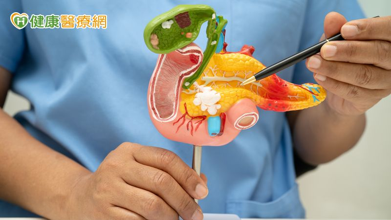 胰臟癌治療迎進展！新藥臨床試驗顯示患者存活期延長　研究結果獲臨床關注
