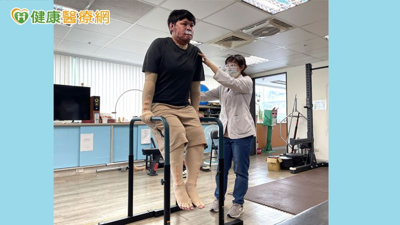 70%嚴重燒傷！30歲青年忍「皮膚撕裂」復健劇痛　半年重拾自主力