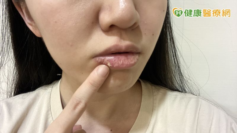 朱柏全主任解釋，撕嘴皮可能會暫時轉移注意力，並得到短暫的放鬆，對大腦獎勵機制而言屬於正向回饋，促使人們日後不斷重複同樣的行為。