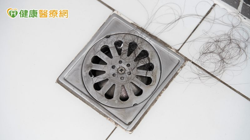 洗完頭發現排水孔都是頭髮？中醫解析4大掉髮類型　圓形禿別輕忽