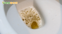 健檢腎功能正常別大意！醫：蛋白尿異常恐是洗腎警訊