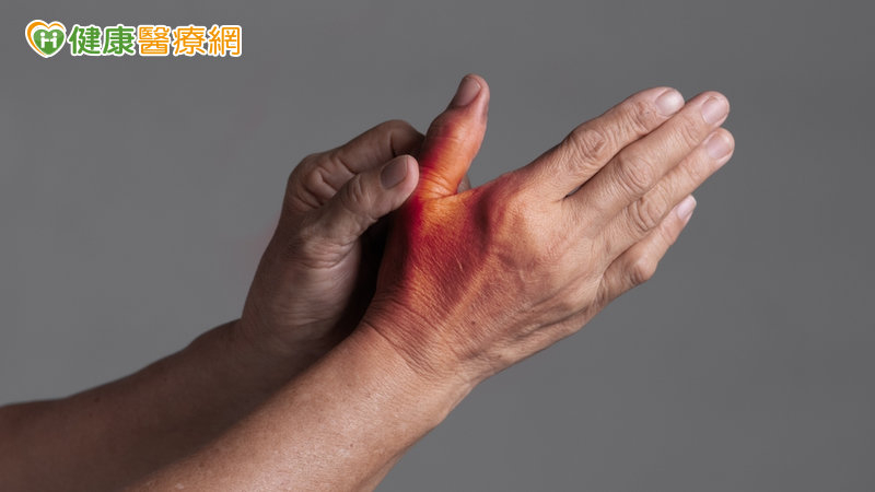 大拇指痛到無法拿鍋鏟 竟是「拇指腕掌關節炎」惹禍