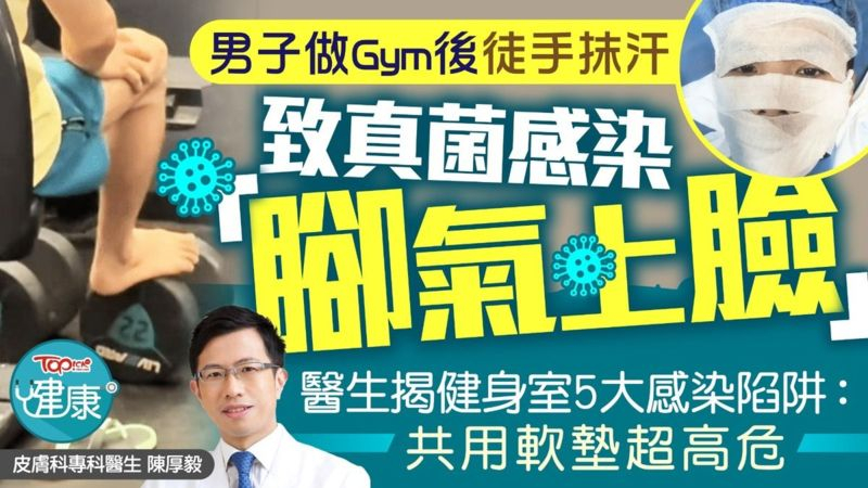 男子做Gym後徒手抹汗致真菌感染「腳氣上臉」　醫生揭健身室5大感染陷阱：共用軟墊超高危