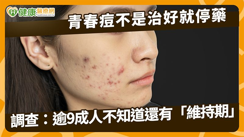 青春痘不是治好就停藥　調查：逾9成人不知道還有「維持期」