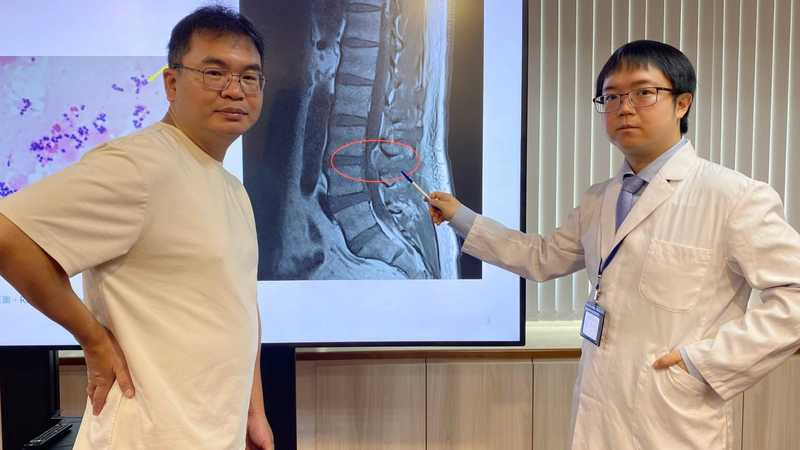 林男（左）因發燒、腰痛，檢查發現金黃色葡萄球菌感染，引發腰椎硬脊膜外膿瘍合併脊椎骨髓炎、心內膜炎。 （記者陳金龍攝）