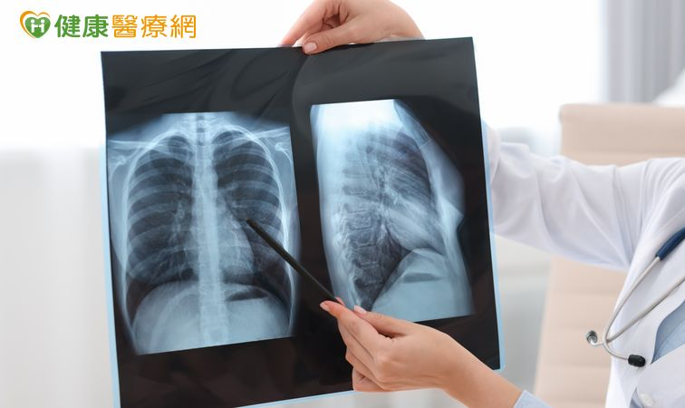 肺癌已連續多年蟬聯國人癌症死因首位，其中非小細胞肺癌為最常見類型，而亞洲患者約有6成帶有EGFR基因突變，比例遠高於歐美國家