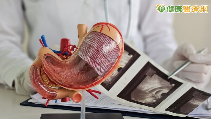 健檢揪出「胃腸道基質瘤」！無痛微創切除化解惡性腫瘤