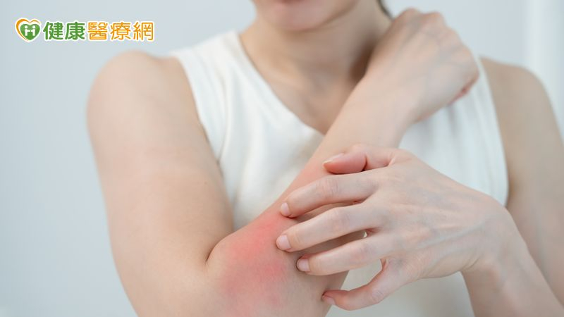 夏天皮膚癢原因大不同　為何汗水或衣物也可能是刺激來源？皮膚醫解析