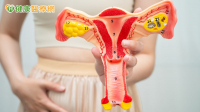 女性常見「多囊」改名了！PCOS更名PMOS　醫揭「P、M、O各代表什麼」
