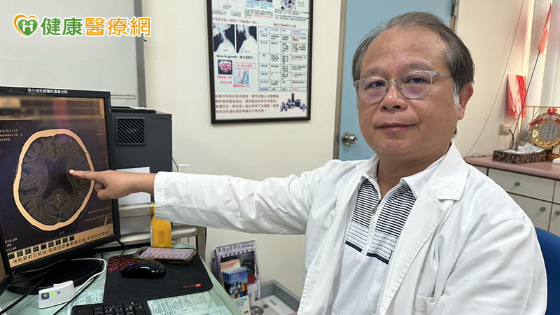 長者走路像「黏在地上」還尿失禁　小心「交通性水腦症」作祟