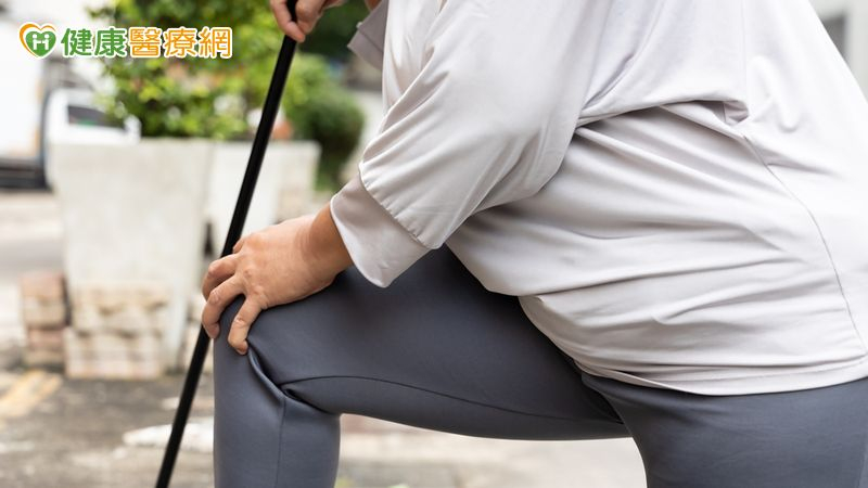 體重101公斤、膝痛3年！63歲婦一度要換人工關節　醫建議：先處理體重