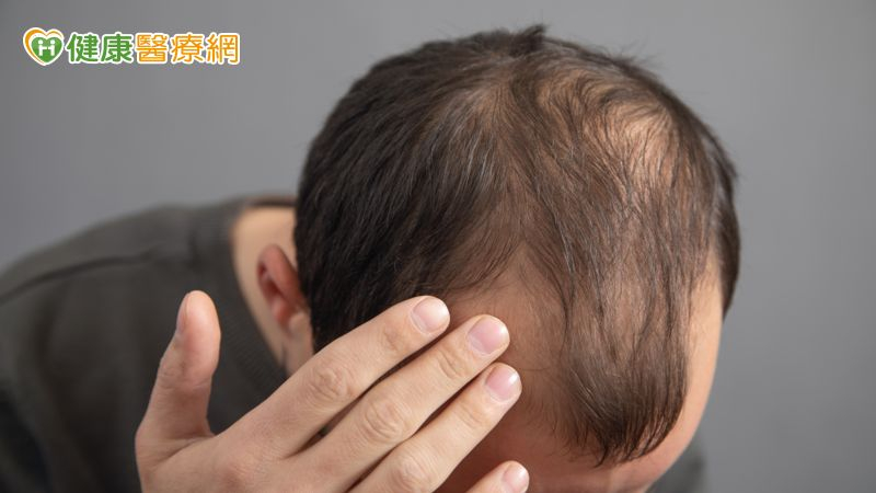 37歲男頭髮愈來愈少以為雄性禿！抽血揪「真正原因」　竟是缺這營養素
