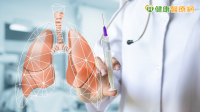 65歲男健檢揪出0.9公分肺結節！AI輔助3D影像協助肺段切除評估