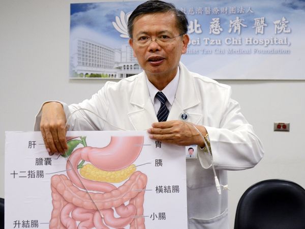 12指肠灌食方式 确保烫伤者摄取足够营养