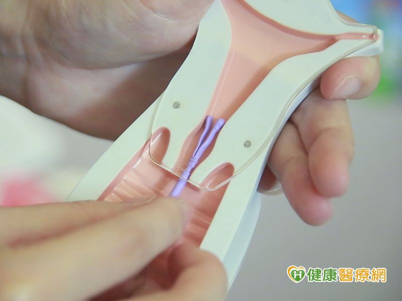 正確避孕觀念免意外懷孕當小媽媽 健康醫療網 健康養生新聞資訊網路媒體