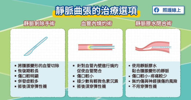 腿部靜脈曲張的治療選項